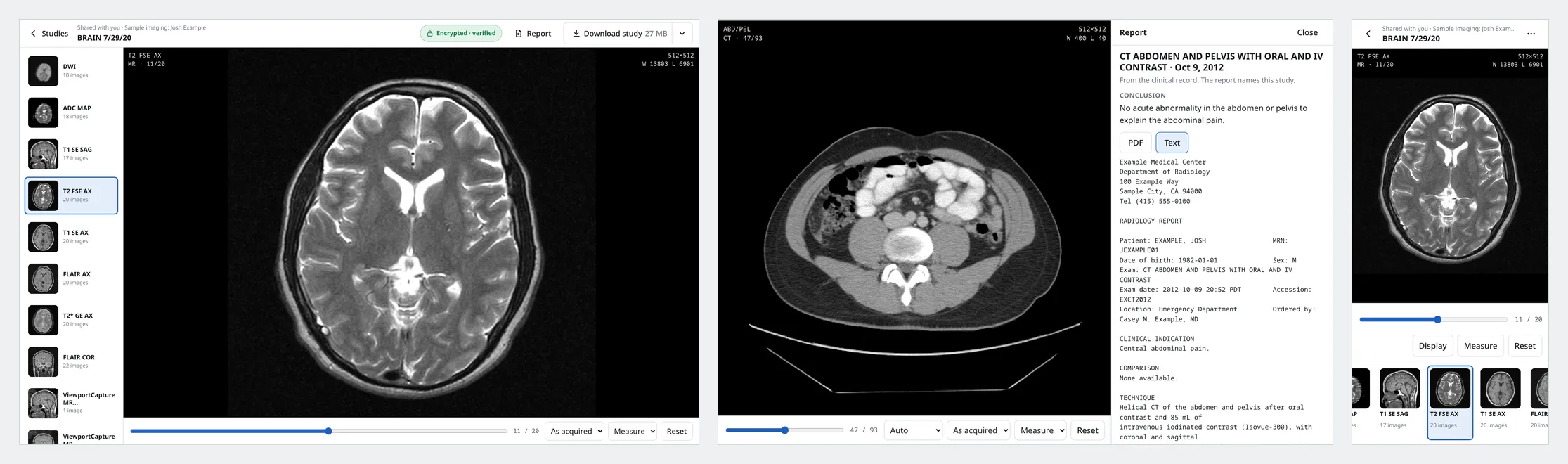 The sample MRI and CT on desktop and phone